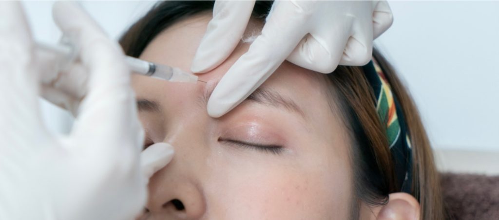 Botox 肉毒 多伦多