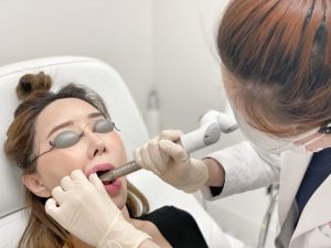 激光口腔内面部提升