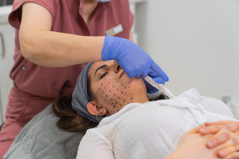 Thermage 热玛吉 多伦多