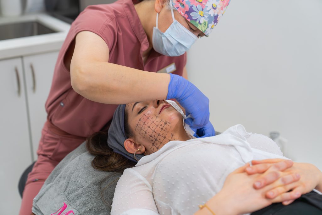 Thermage 热玛吉 多伦多