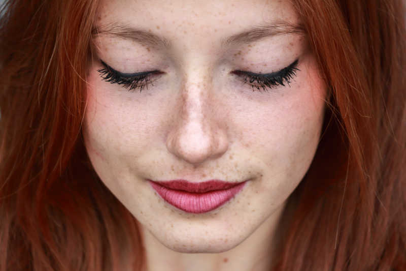 多伦多美蒂芳华医美诊所详解晒斑光子嫩肤后反黑期3个月的科学应对方案，专业VISIA检测+亚洲肤质定制护，让您安全度过恢复期。