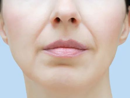 法令纹填充2025：玻尿酸VS童颜针对比 | 多伦多美蒂芳华医美